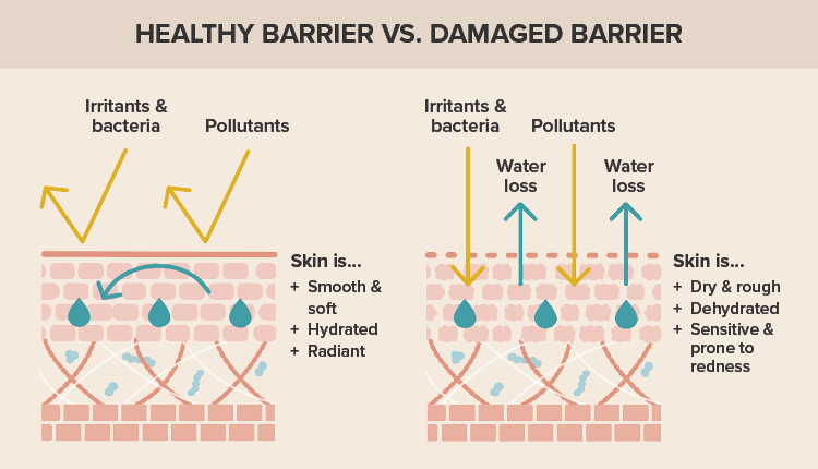 Barriera cutanea sana e barriera cutanea danneggiata